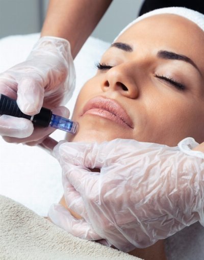 PLASMA ITALY CLASSIC +DERMAPEN