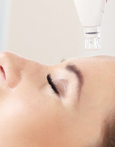 PRP  HA +DERMAPEN