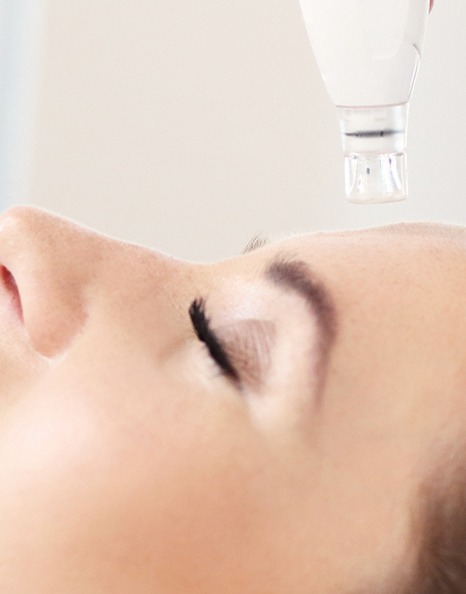 PRP  HA +DERMAPEN