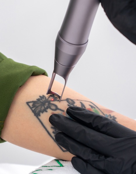 1 SESSION TATTOO -S WITH SPECTRA