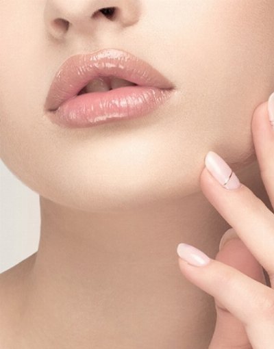 Filler Juvederm Ultra 4