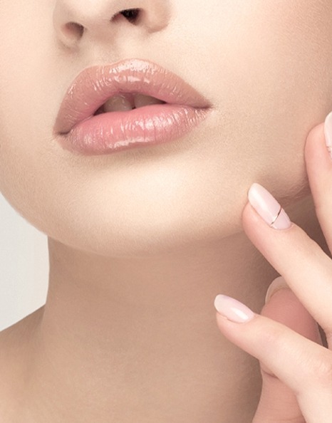 Filler Juvederm Ultra 4